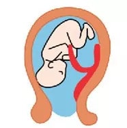 胎盘位置低能顺产吗