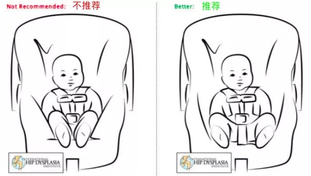 宝宝臀纹或腿纹不对称是髋关节发育不良吗？