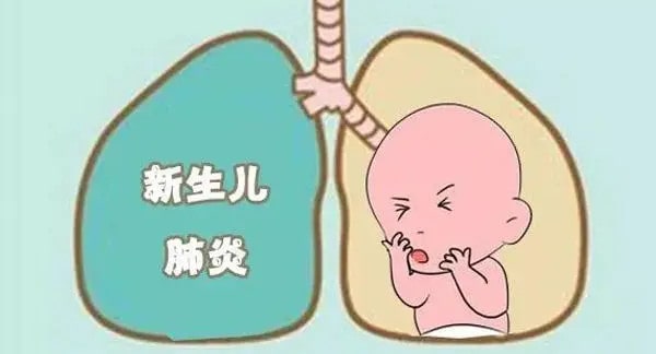 新生儿肺炎护理