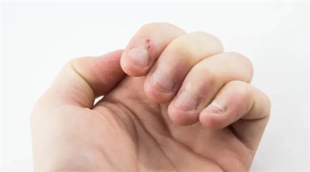宝宝指甲透露的5种健康信号