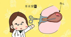 高龄产妇的检查项目