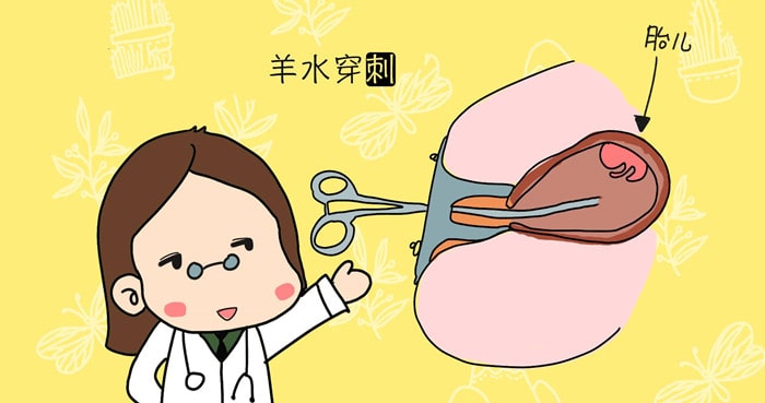 高龄产妇的检查项目