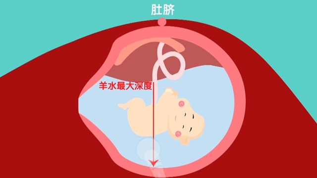 胎儿羊水量多少算羊水过多和过少？