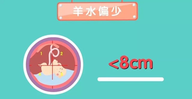 胎儿羊水量多少算羊水过多和过少？