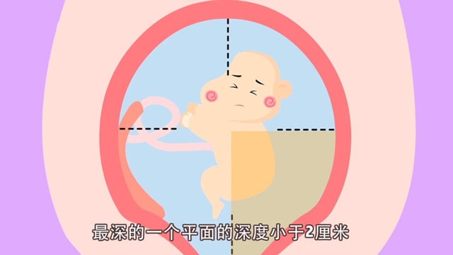 胎儿羊水量多少算羊水过多和过少？