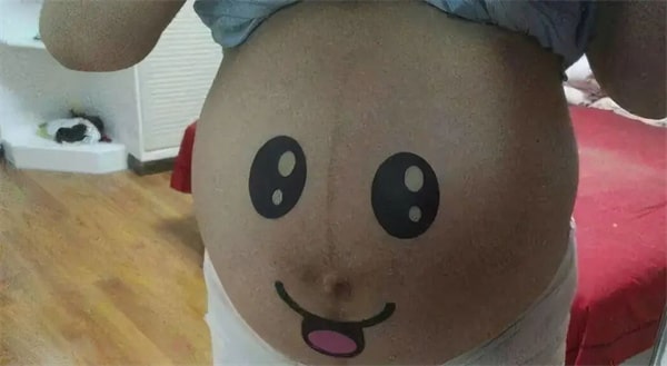 孕妇肚脐有凹有凸，和生男生女有关？