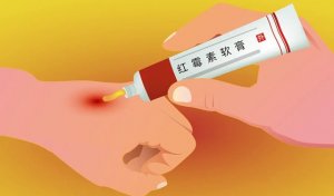 红霉素软膏的作用及功能