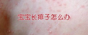 宝宝长痱子怎么办
