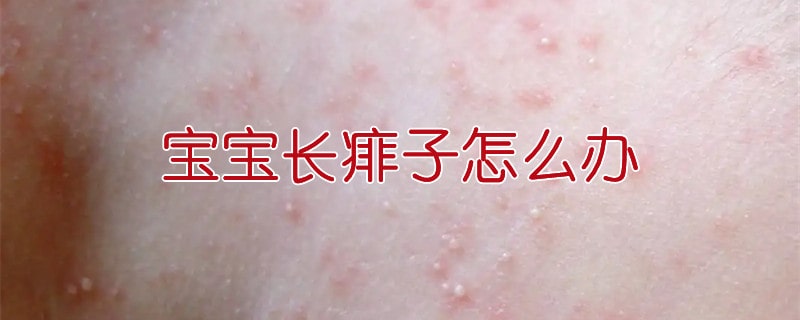 宝宝长痱子怎么办
