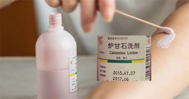 炉甘石洗剂开瓶后能用多久？