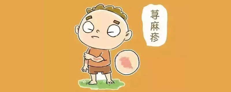 荨麻疹是什么