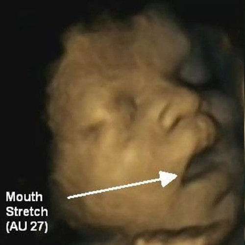 胎儿无聊时在妈妈肚子里都干点啥？