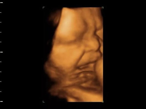 胎儿无聊时在妈妈肚子里都干点啥？