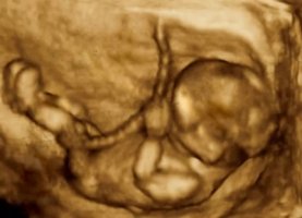 胎儿无聊时在妈妈肚子里都干点啥？