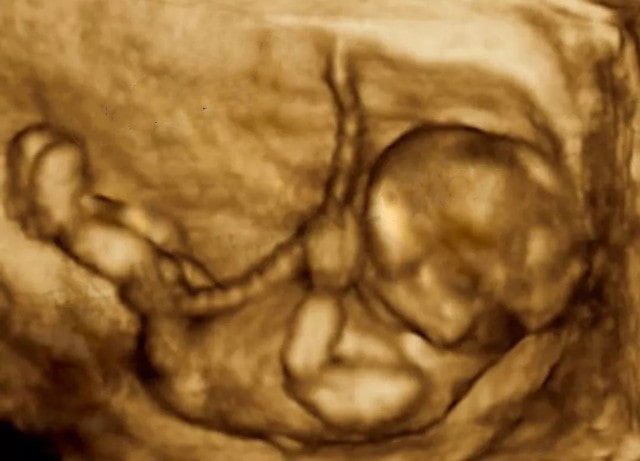 胎儿无聊时在妈妈肚子里都干点啥？