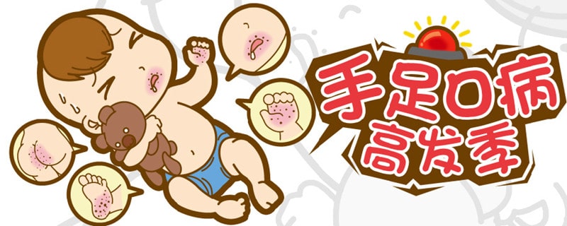夏季该如何防治小儿手足口病