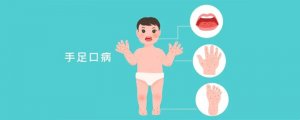 小儿手足口病的症状表现