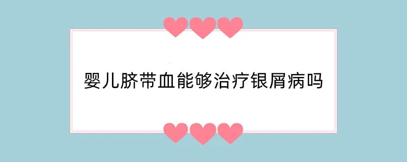 婴儿脐带血能够治疗银屑病吗