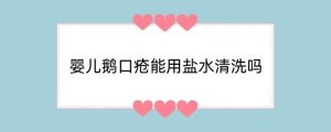 婴儿鹅口疮能用盐水清洗吗
