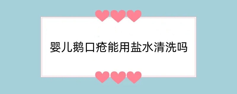 婴儿鹅口疮能用盐水清洗吗