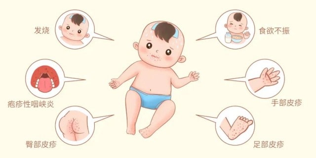 天气逐渐变冷做到这5点，孩子健康少生病