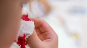 小孩子经常流鼻血怎么治疗