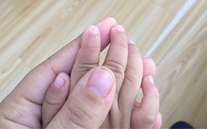 如何破解宝宝指甲上的健康密码？