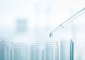 性激素六项是什么 性激素六项什么时候检查