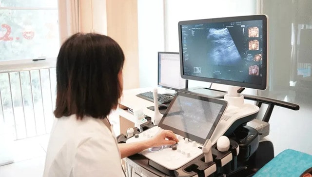 超声大排畸都查什么？