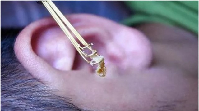 小孩耳屎怎么清