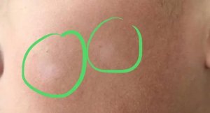 孩子脸上有白斑什么原因造成的