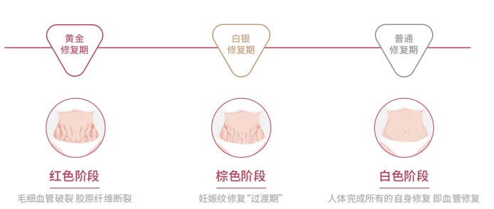 同样是怀胎十月，为什么有的妈妈就没有妊娠纹？