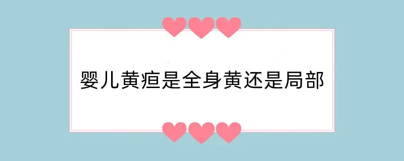 婴儿黄疸是全身黄还是局部