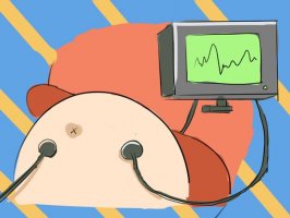 孕晚期每天都要做胎心监护吗