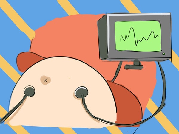 孕晚期每天都要做胎心监护吗