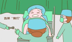 哪些顺产妈妈需要侧切？可以提前预防吗？