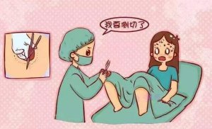 顺产哪些情况需要侧切