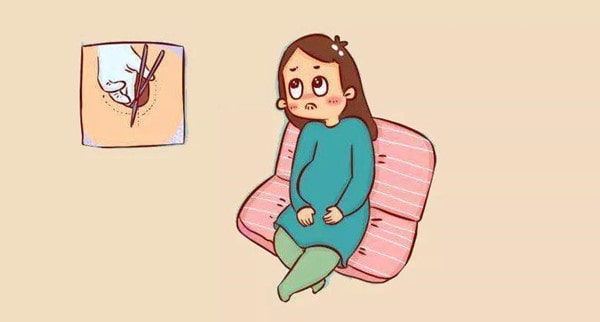 哪些孕妇顺产容易会阴侧切