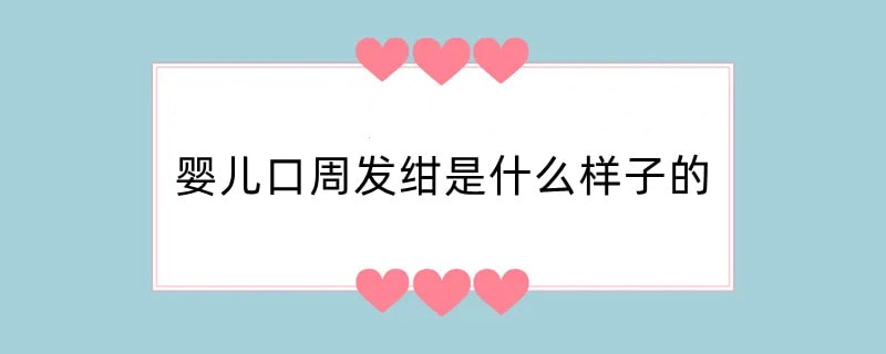 婴儿口周发绀是什么样子的