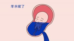 羊水破了之后多久会生产？