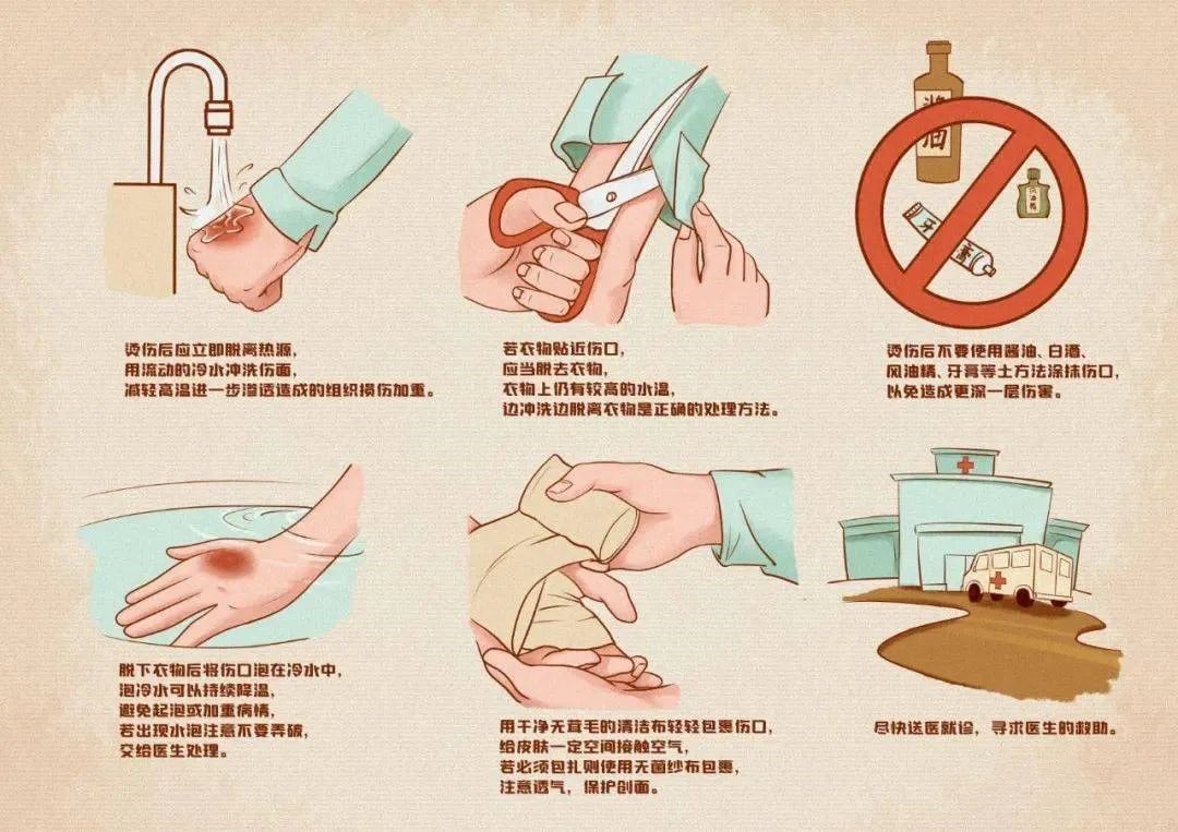 孩子被烫伤后正确的处理方法