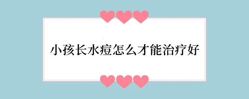 小孩长水痘怎么才能治疗好