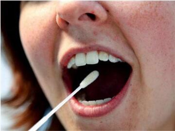 接吻会传染艾滋病吗