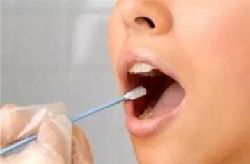 接吻会传染艾滋病吗