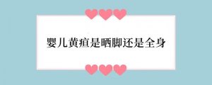 婴儿黄疸是晒脚还是全身