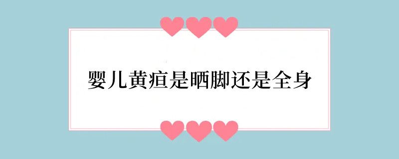 婴儿黄疸是晒脚还是全身