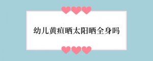 幼儿黄疸晒太阳晒全身吗