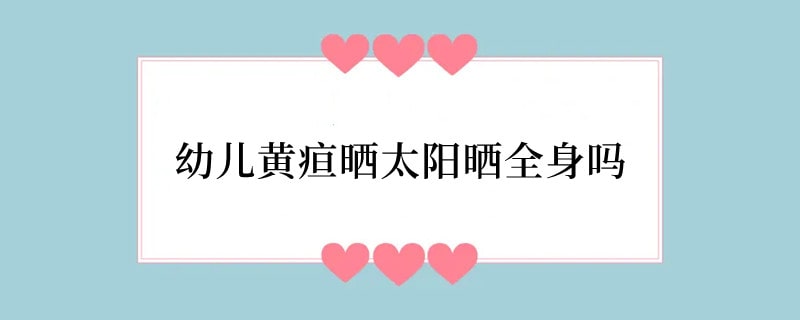 幼儿黄疸晒太阳晒全身吗