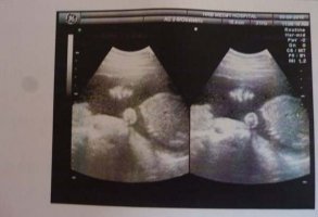 孕妇三维最迟什么时候做