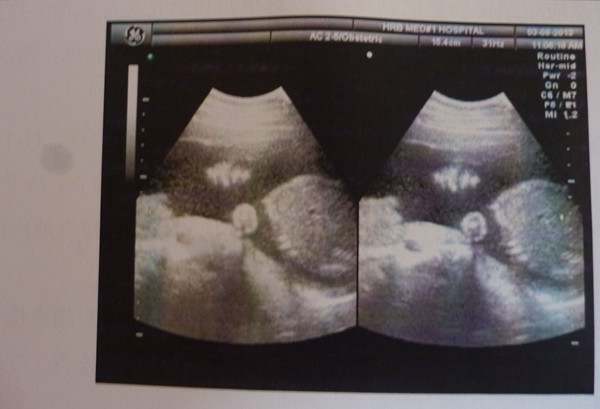 孕妇三维最迟什么时候做